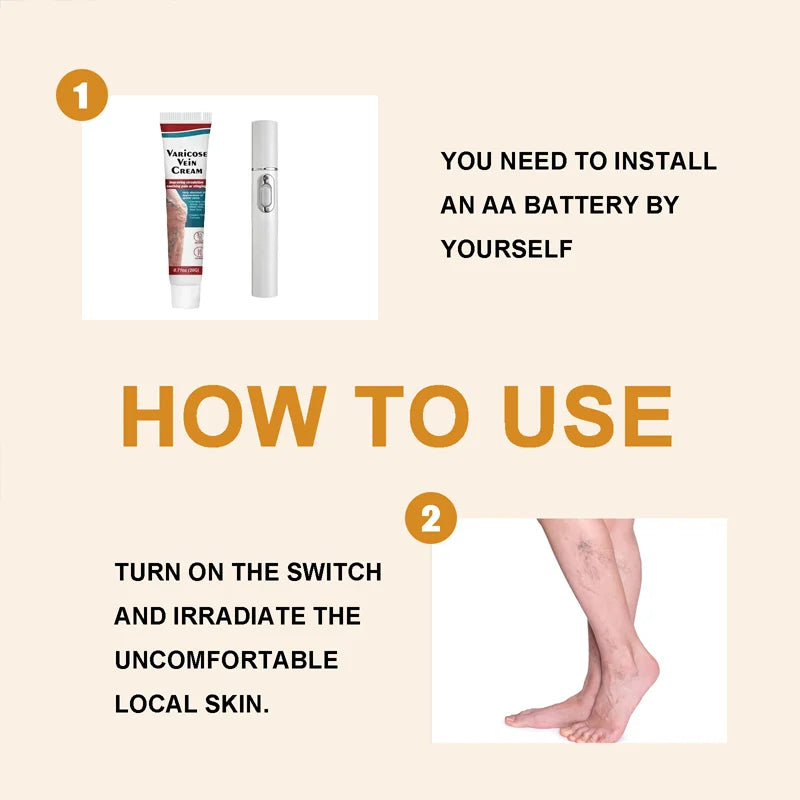 Safe Laser Pen-Treat Varicose Veins