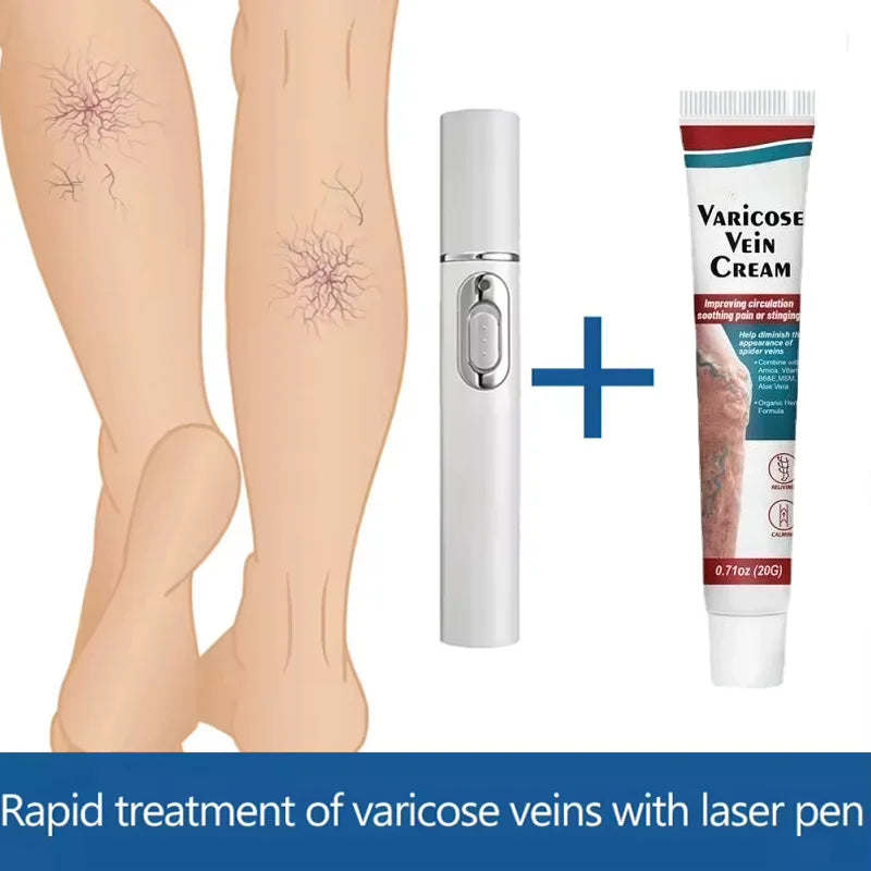 Safe Laser Pen-Treat Varicose Veins