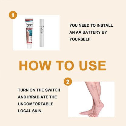 Safe Laser Pen-Treat Varicose Veins